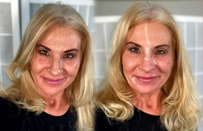 before and after by NaughtyJoJoxxx