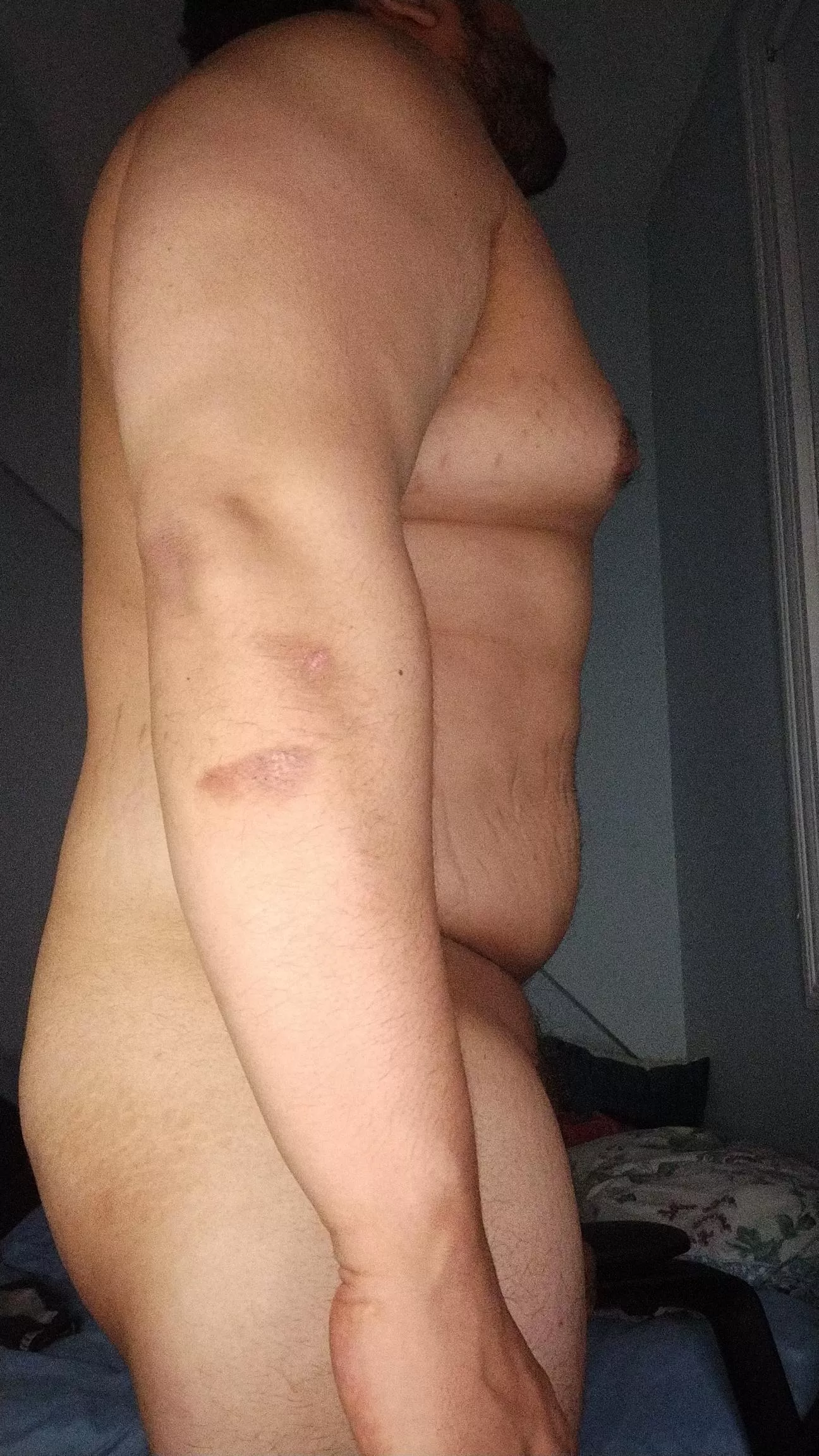 (m) side view  posted by JoeSchmo-oh