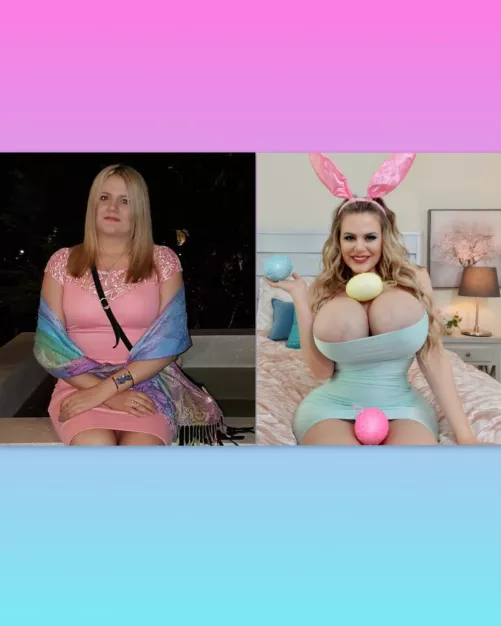 Thankful for my surgeons [oc] by JazmyneDayy