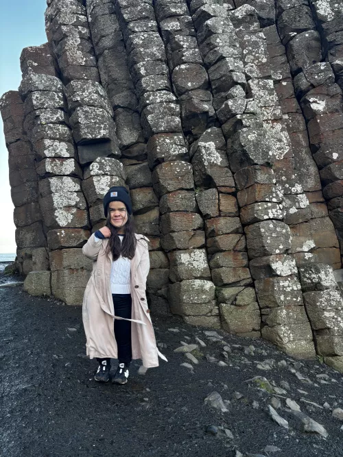 Have you seen the midgets causeway in Ireland? by Dwarfglamourmodel