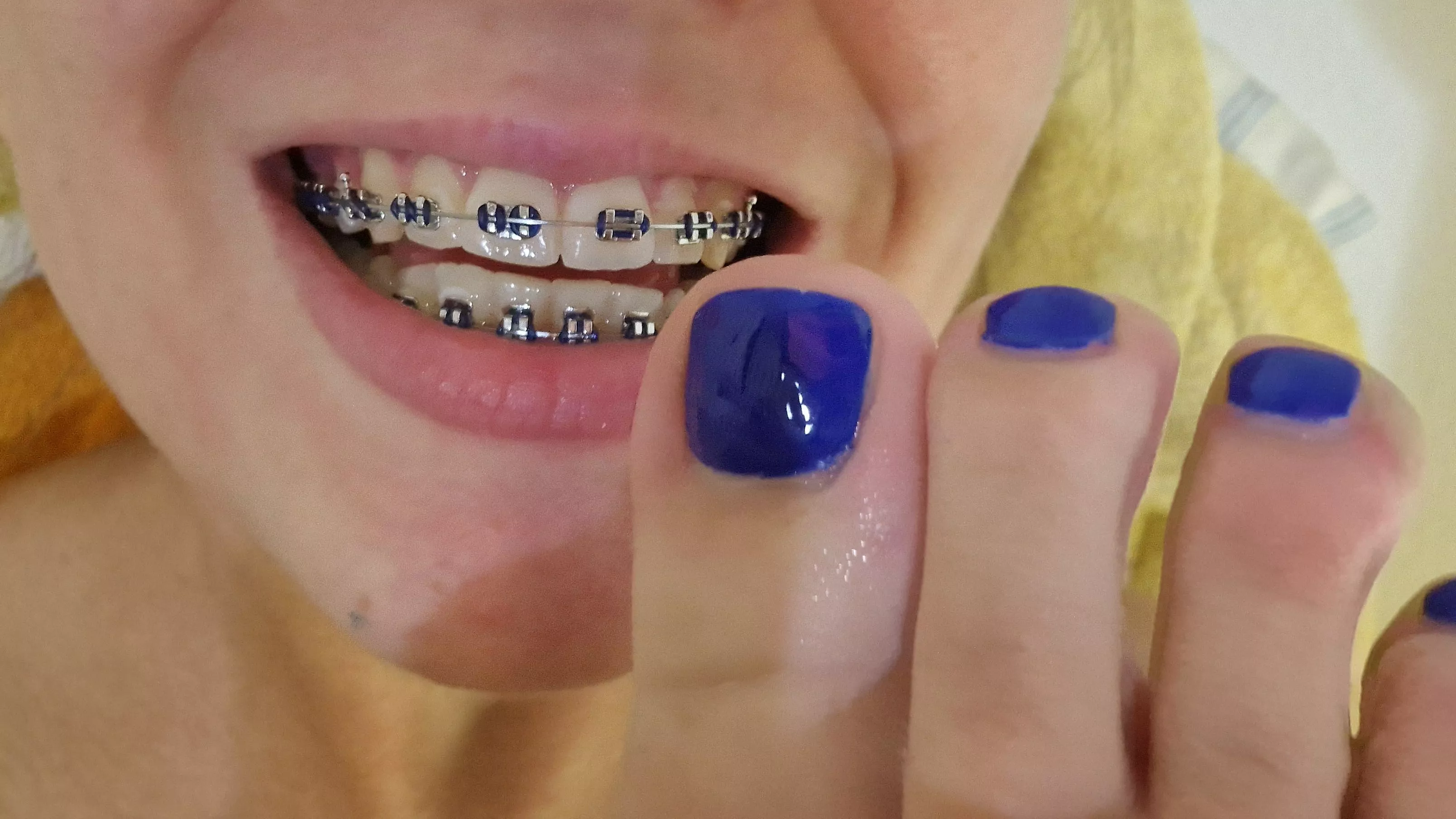 Toes and smiles! Look we are matching  posted by luckyluuna