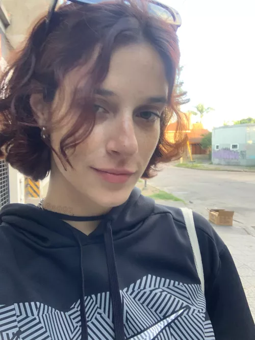 My freckles exploding on the way back from the party [IRTR] by peqqqqqq