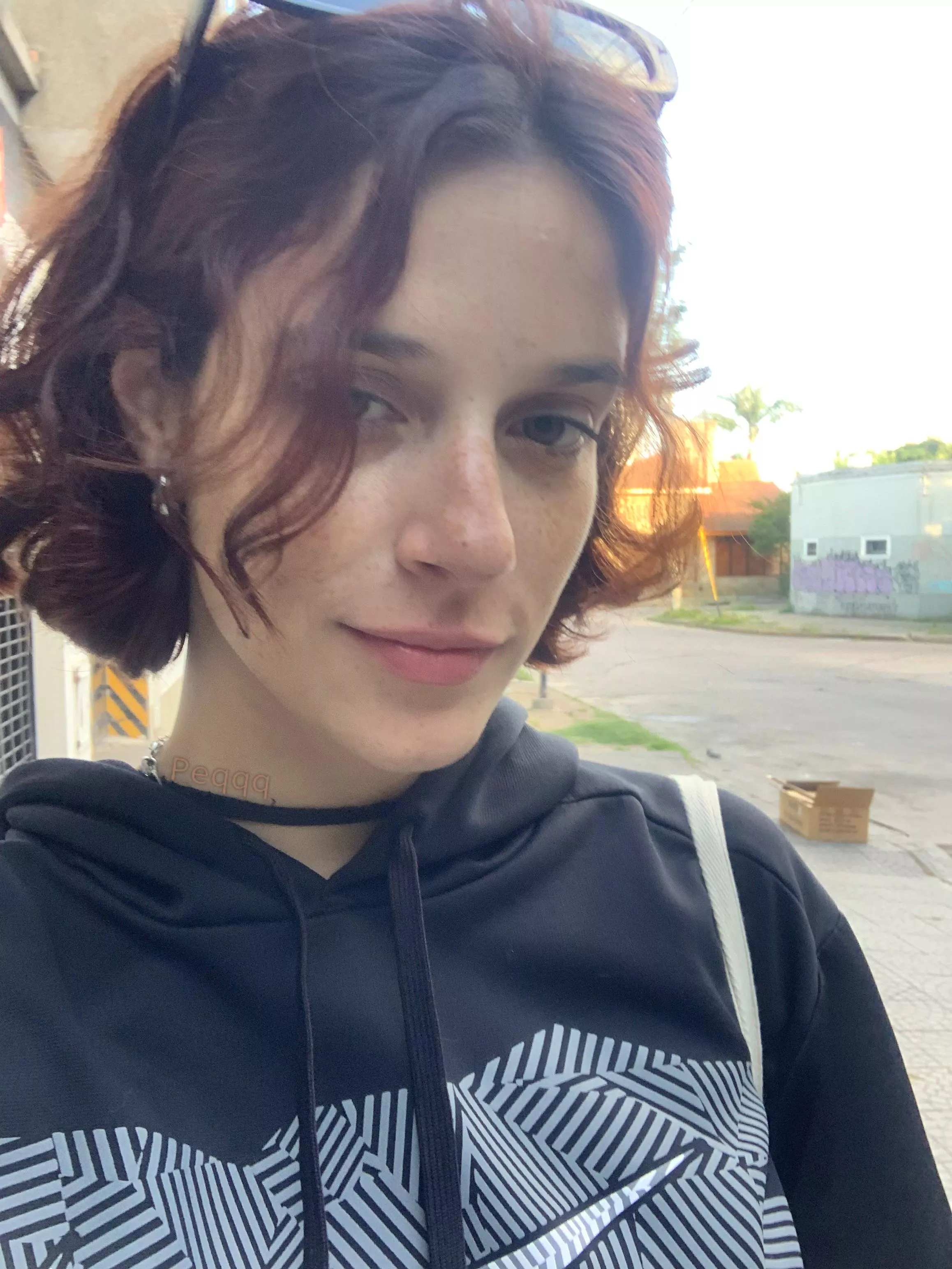 My freckles exploding on the way back from the party [IRTR] posted by peqqqqqq