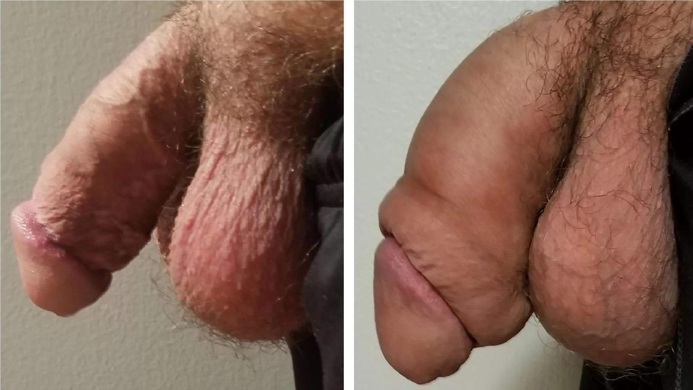 Unpumped and pu[m]ped softies posted by Biggerthebetter42