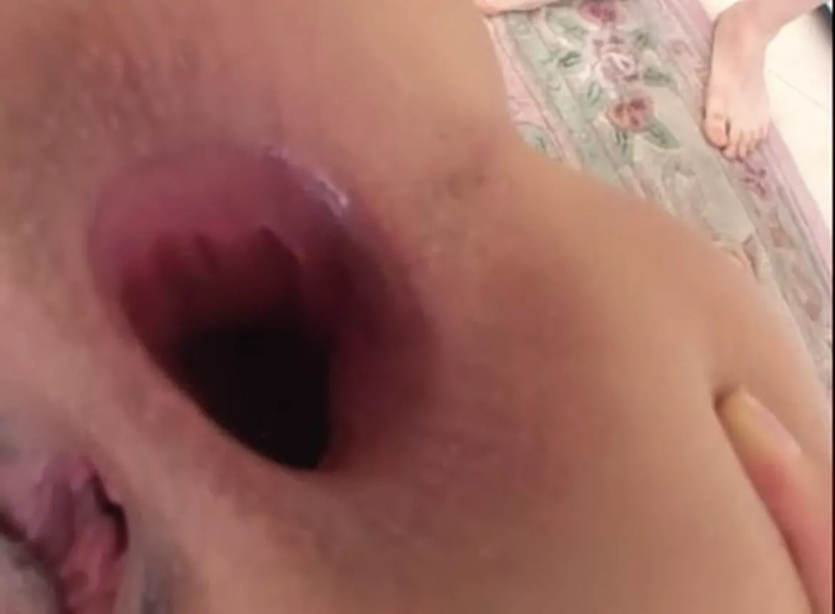 Who guesses whose ass this is? posted by Healthy-Staff6385