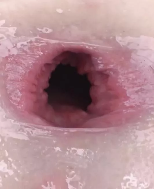 Who guesses whose gape this is? posted by Healthy-Staff6385