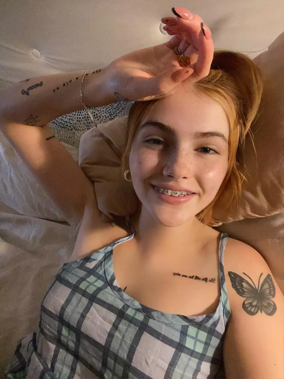 Braces on a teen like me, turn on or off? 🥺 posted by GeminiHarperDuo