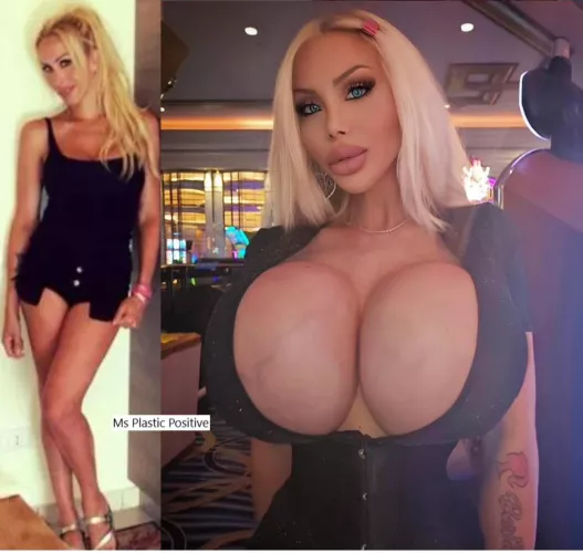 This is the reason why every beautiful girl needs fake tits above 2000c.  by trophylover