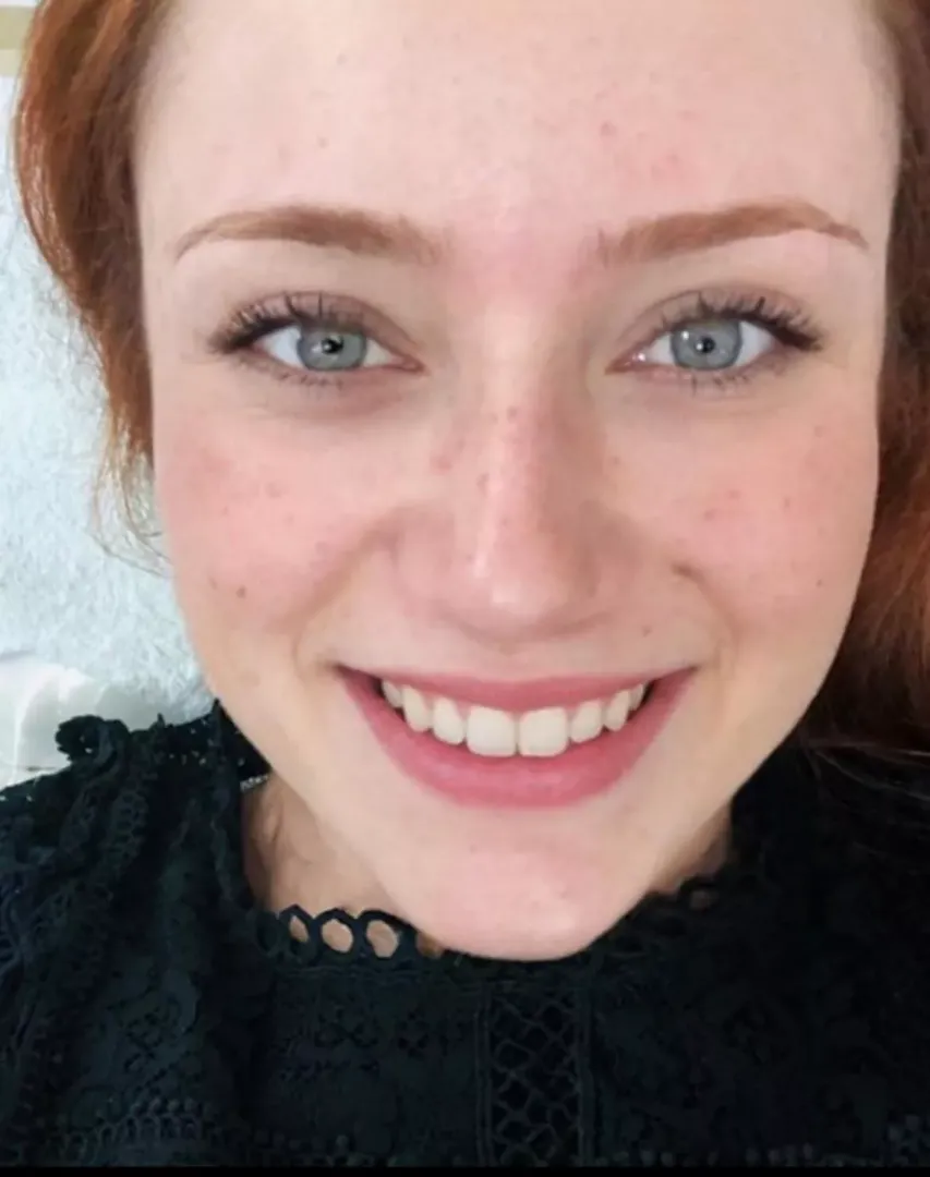 Almost 32 but not wearing makeup to show off my freckles  posted by Puzzled_MJ