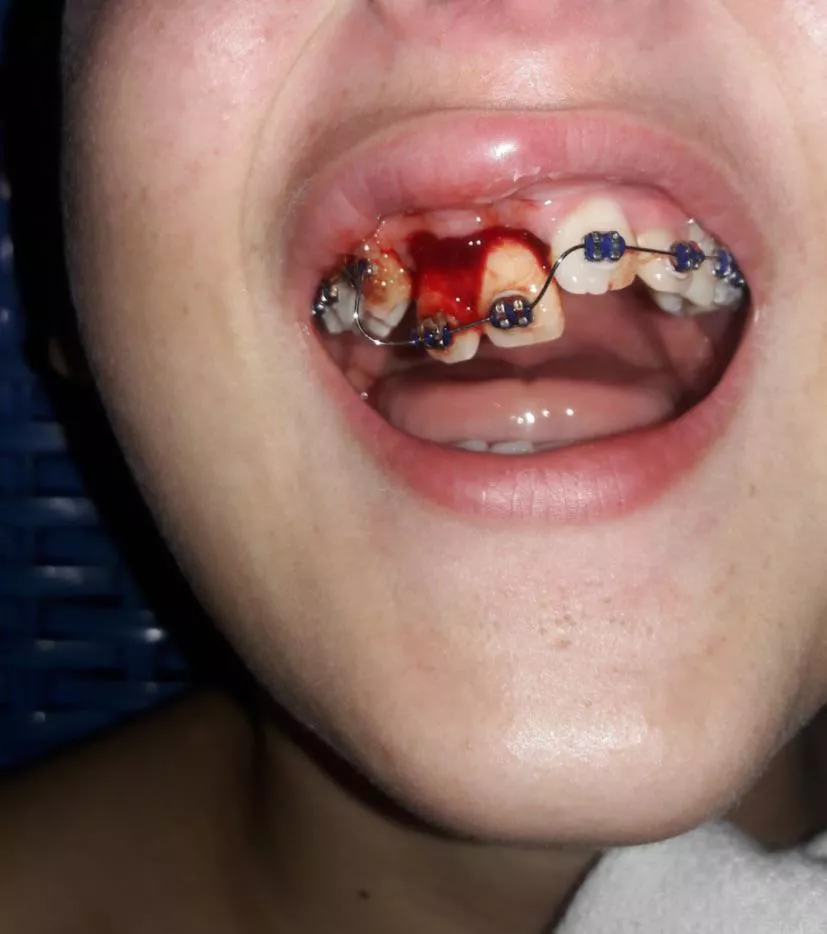 Football scars posted by fodson1