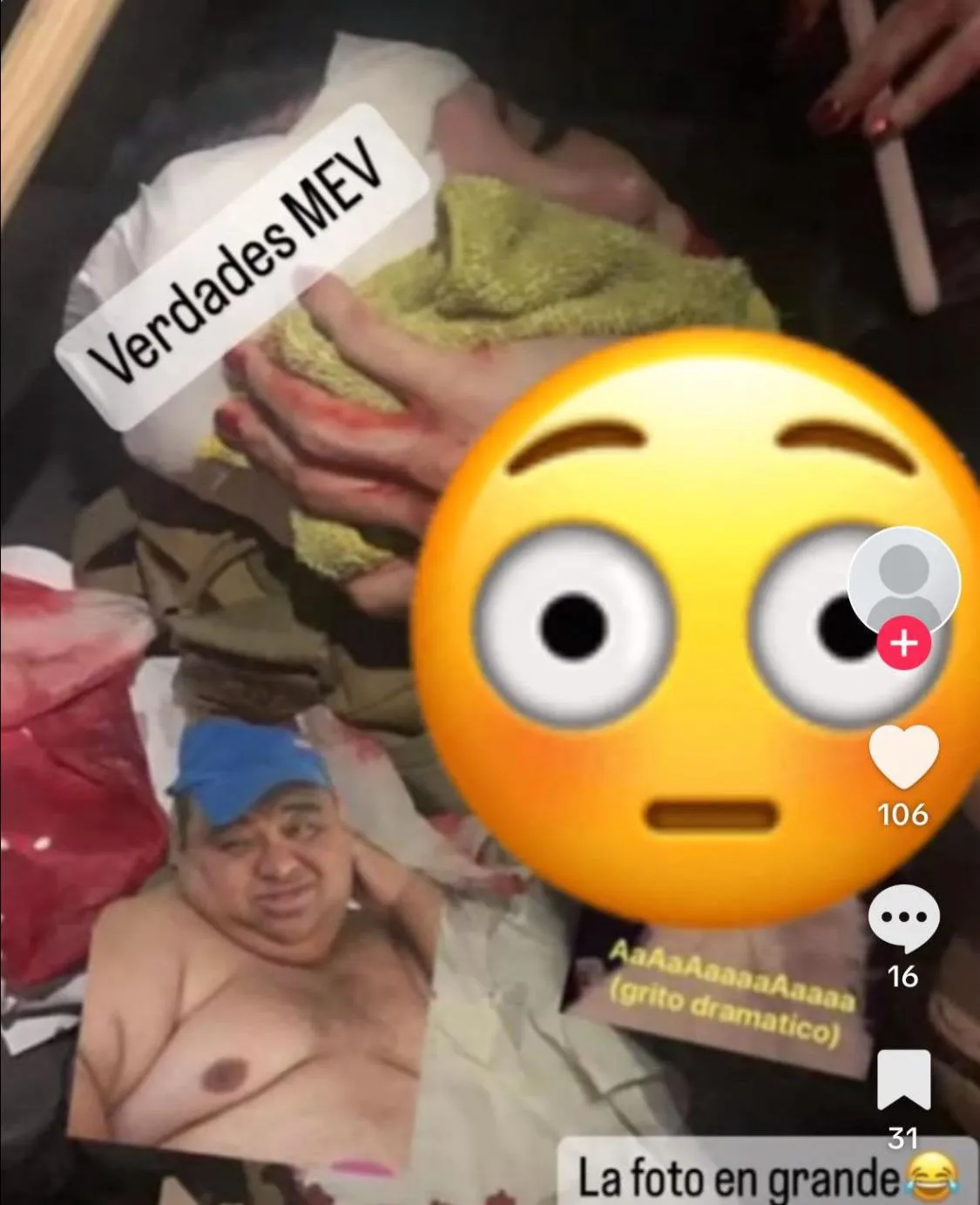 Veronica Guzman after Diana Esparragoza beat her with a bottle for having an affair with her (now ex) husband Alfonso Tirado “El Caballero” posted by Ok_Head368