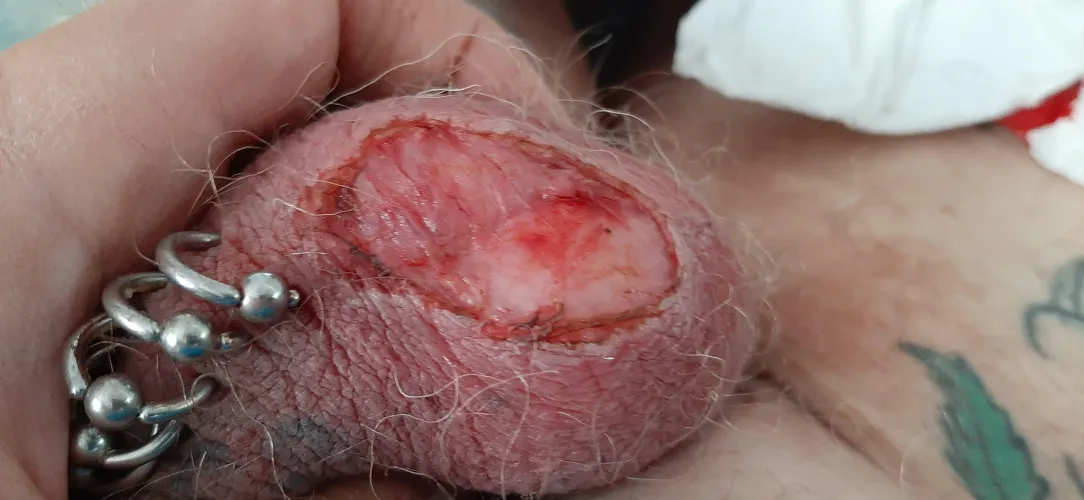 A look into the sack by stefan6206