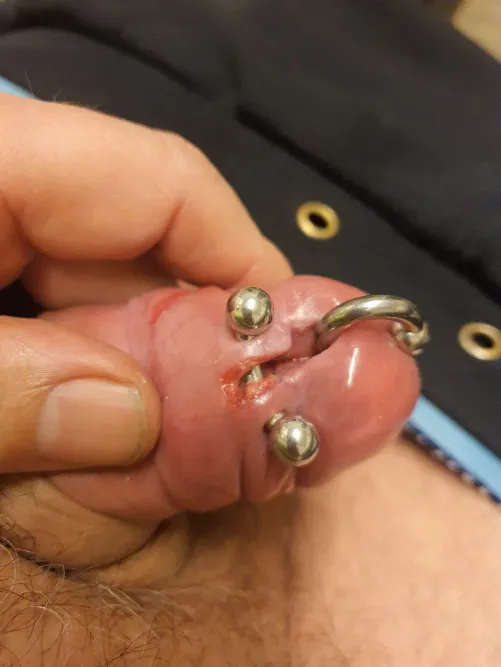 Cut through the frenulem by just-my-piercings