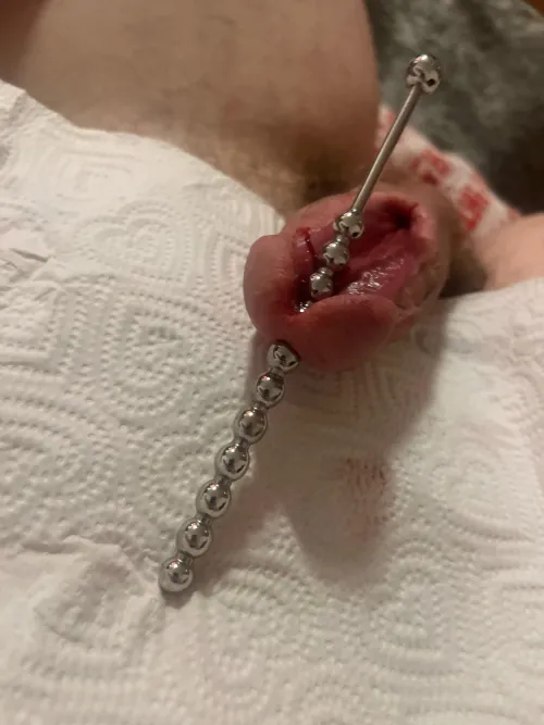 Splitting glans by Acrobatic_Trash_8439