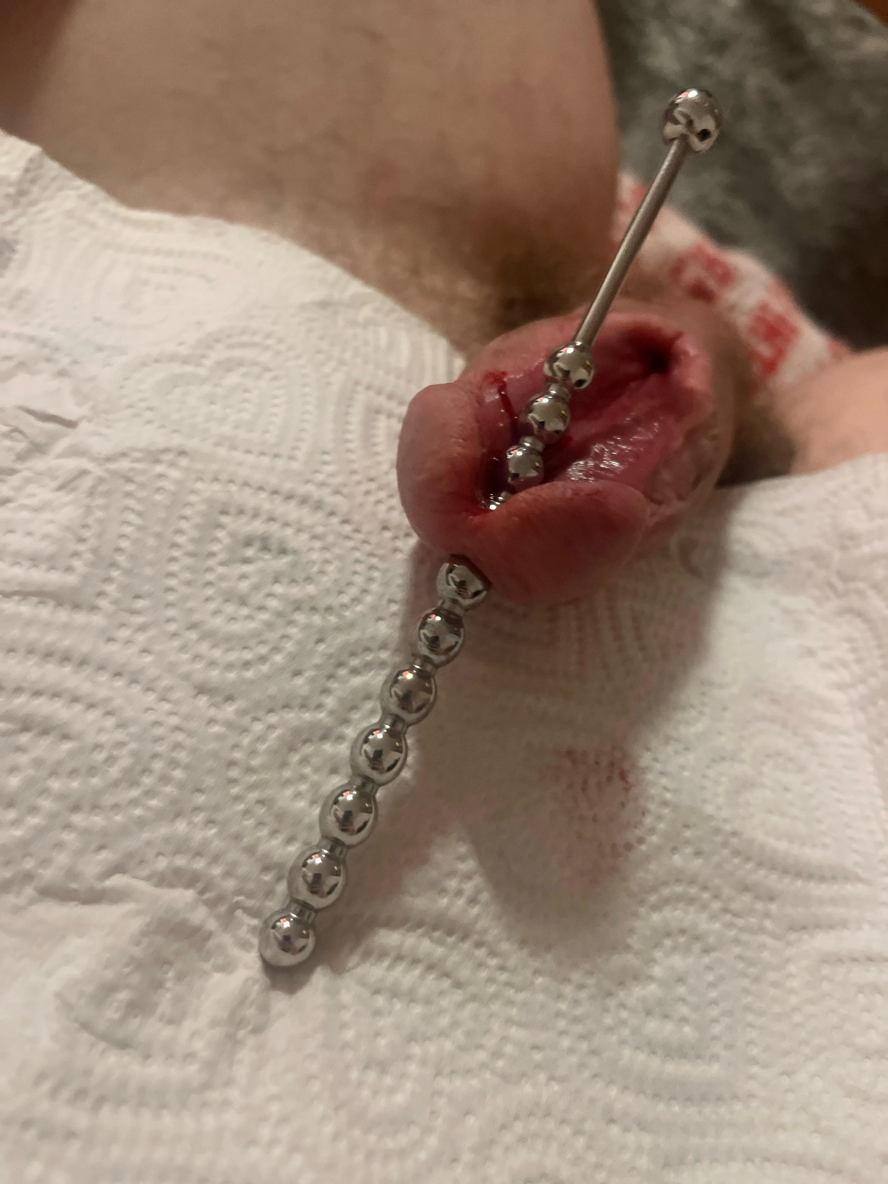 Splitting glans posted by Acrobatic_Trash_8439