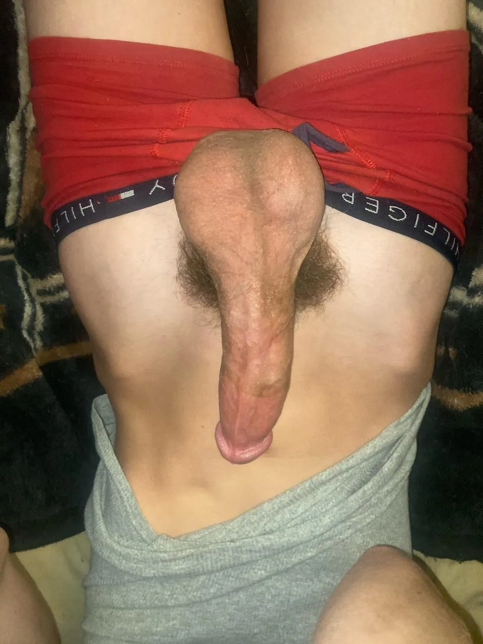 [19] my balls are huge posted by Upbeat-Resource1465