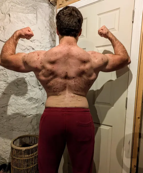 My back is so sensitive by gonnagetbigg