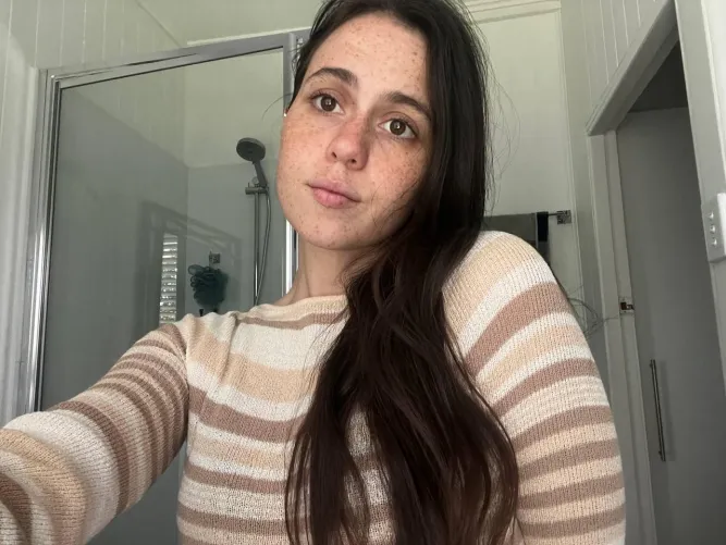 all freckled face by tigeressmonroe