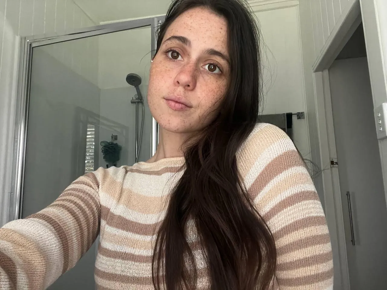 all freckled face posted by tigeressmonroe