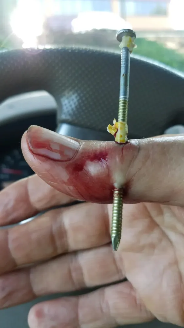 My dad was trying to teach some kids how to use a nail gun by squirrelmonkie