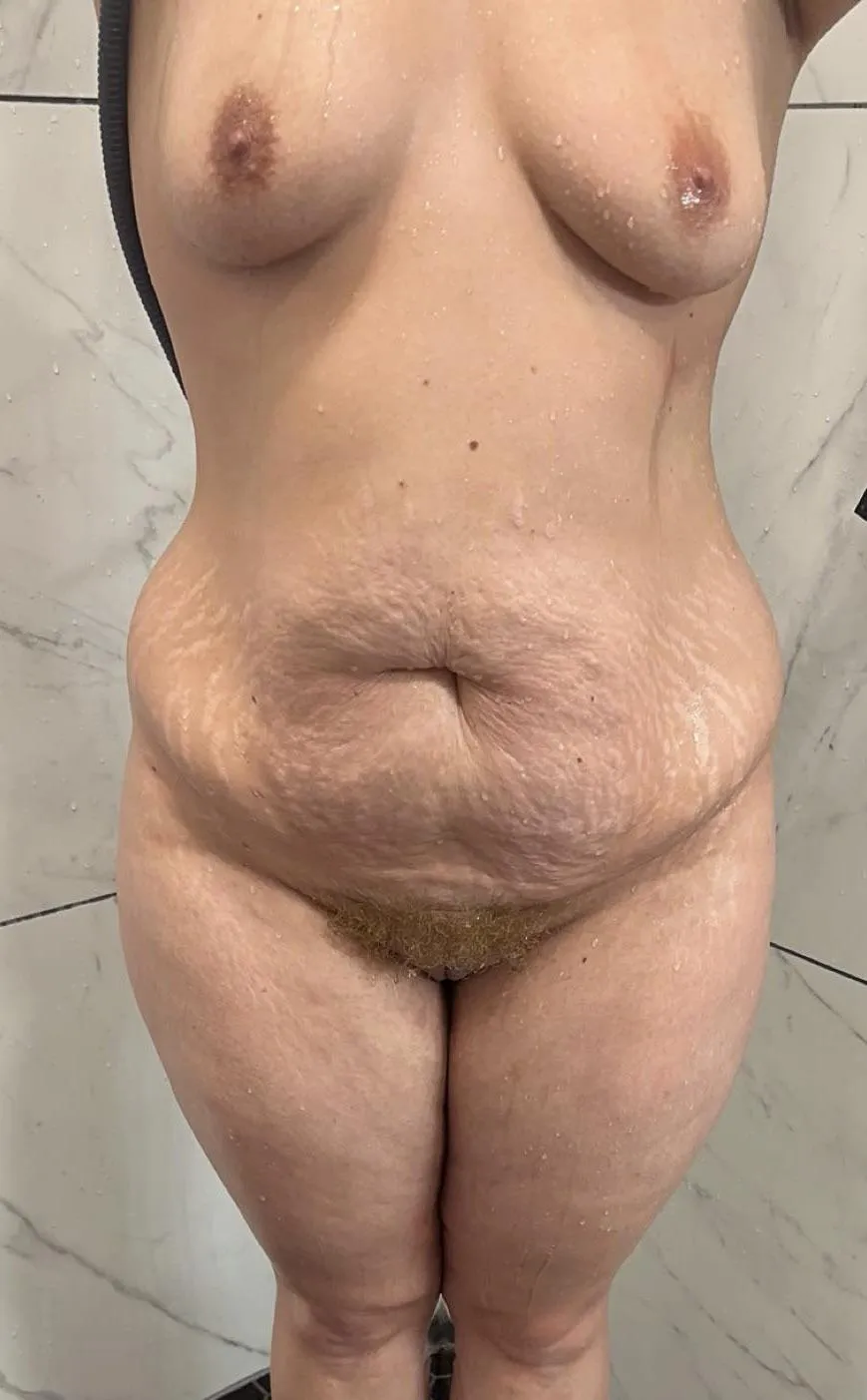 After 2 kids am I sexy? 😉 posted by FlatAcanthisitta9544