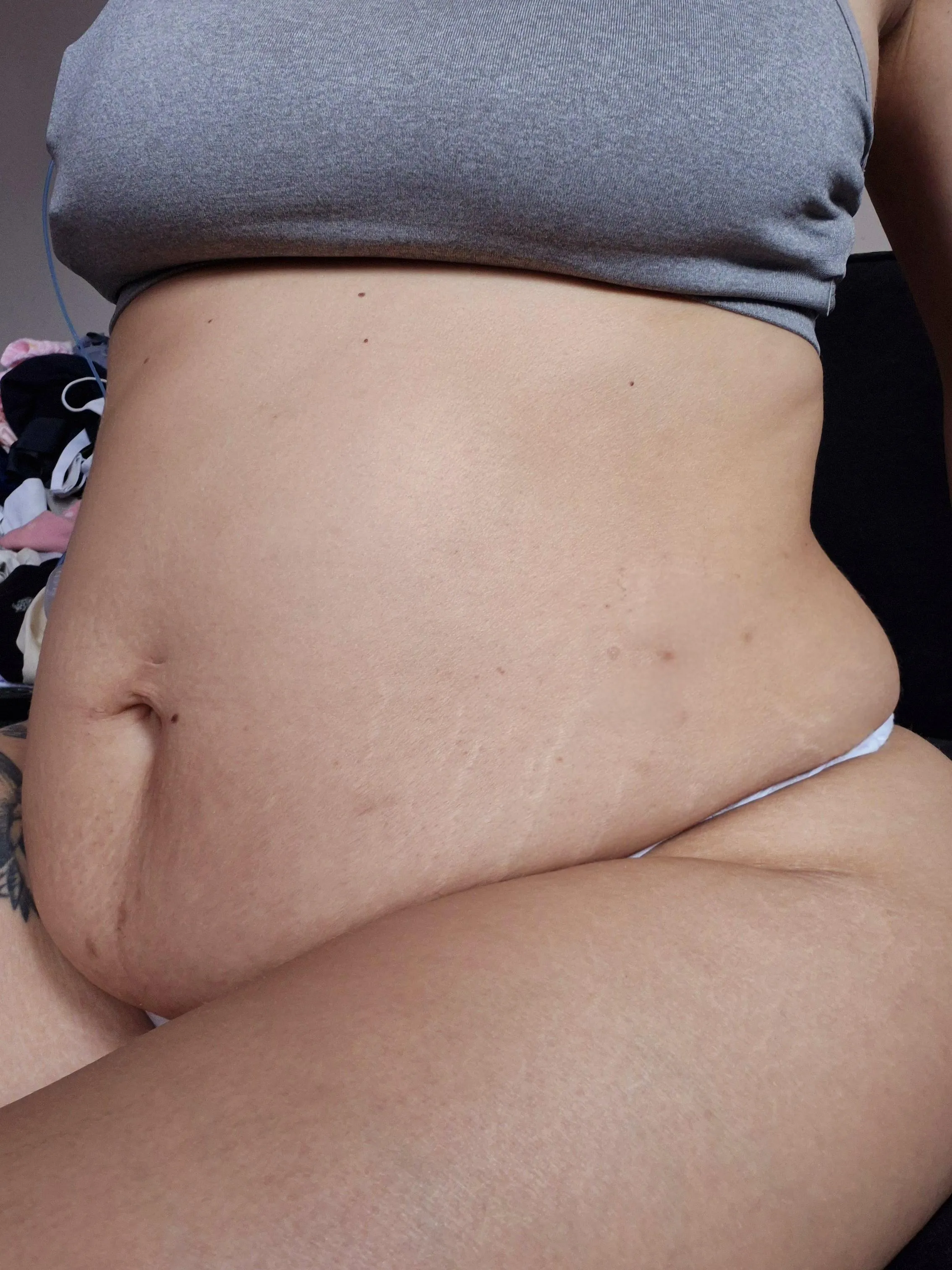 Full of white stretchmarks posted by jumbo_jugz