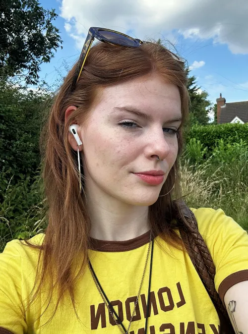 just serving the freckles by Significant_Idea9591