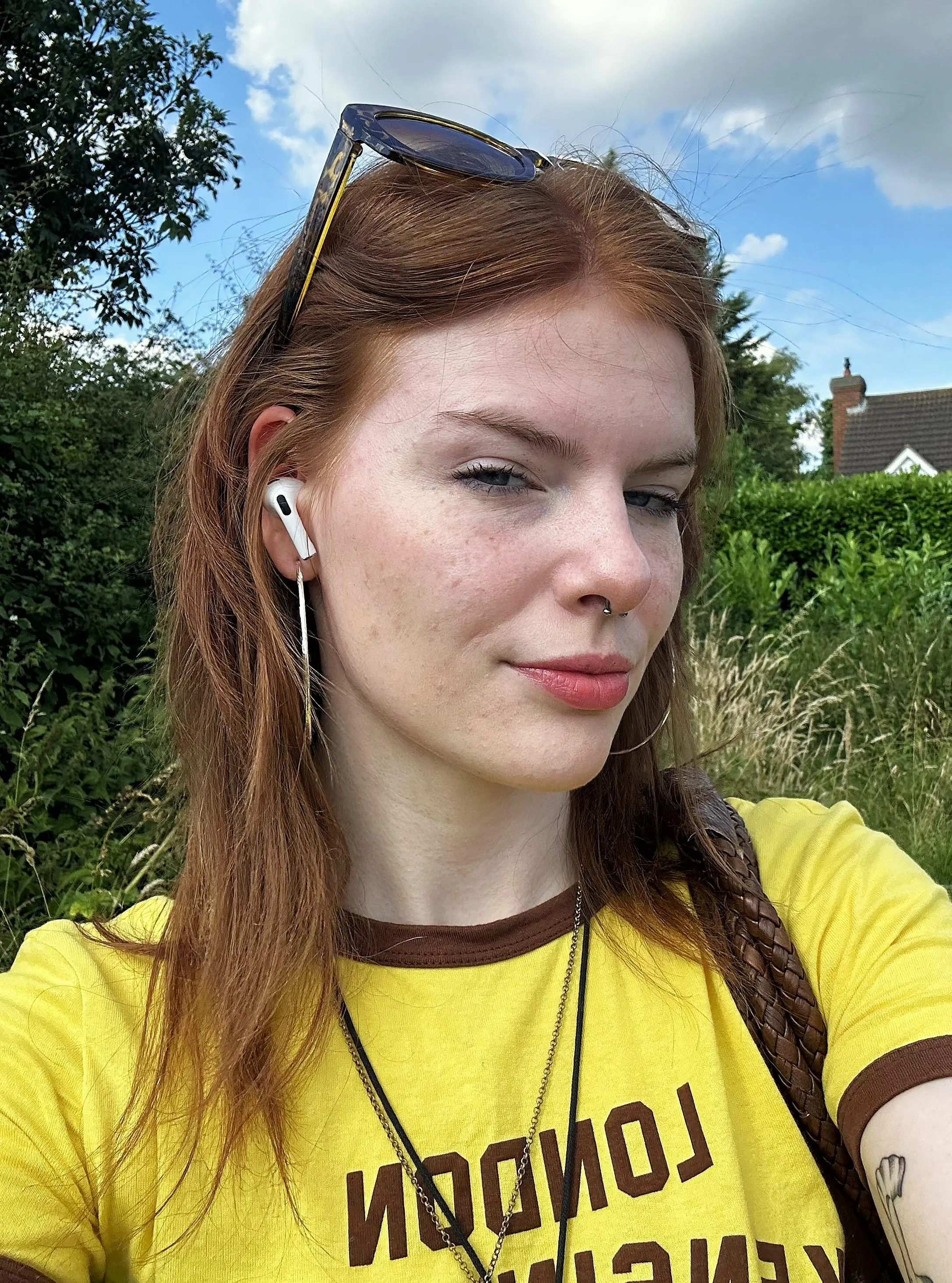 just serving the freckles posted by Significant_Idea9591