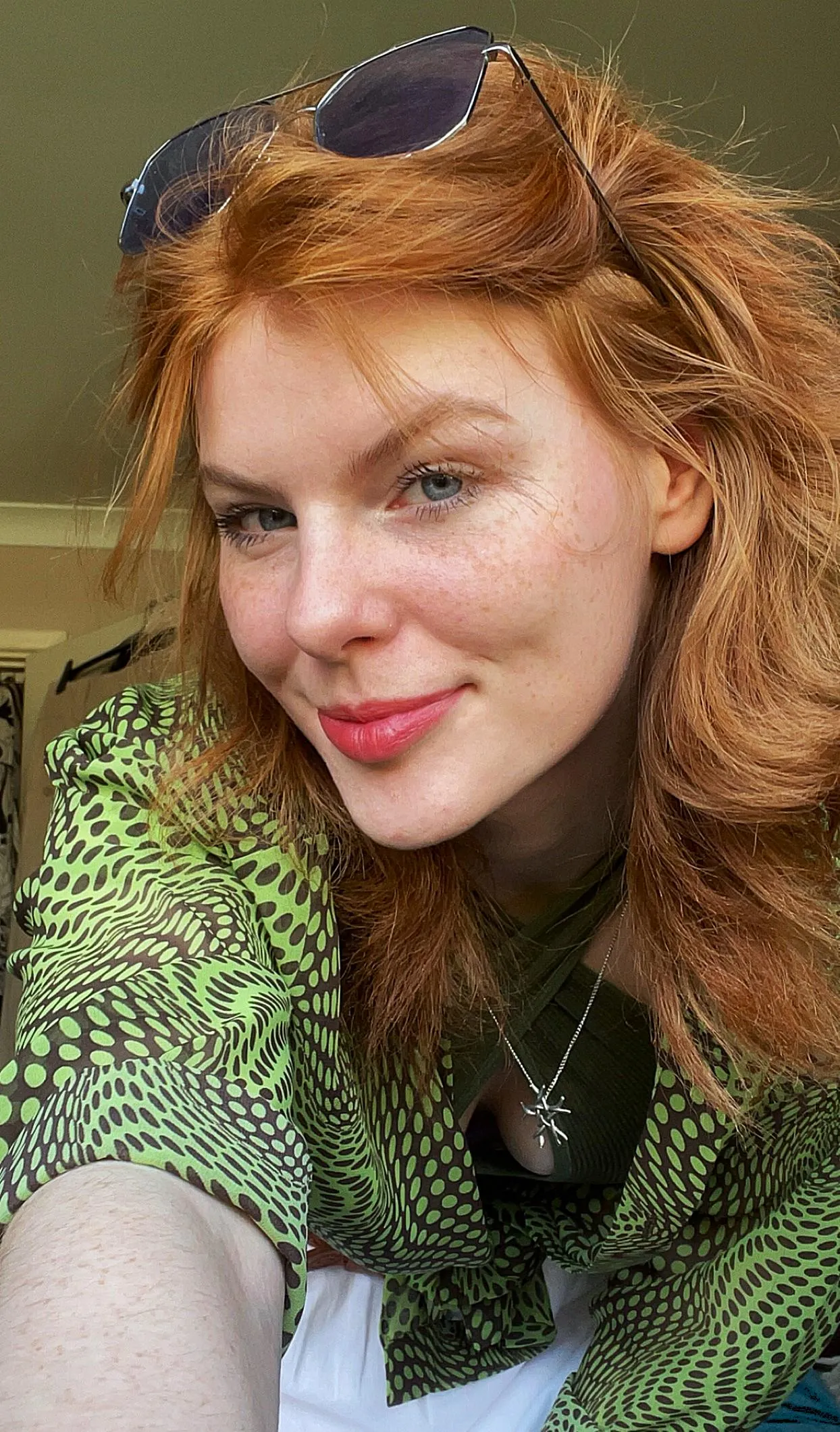 Living proof that freckles are just nature’s kisses[IRTR] posted by Significant_Idea9591