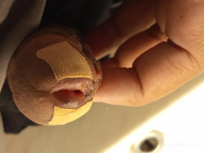 Post cut 2 days by fadilG