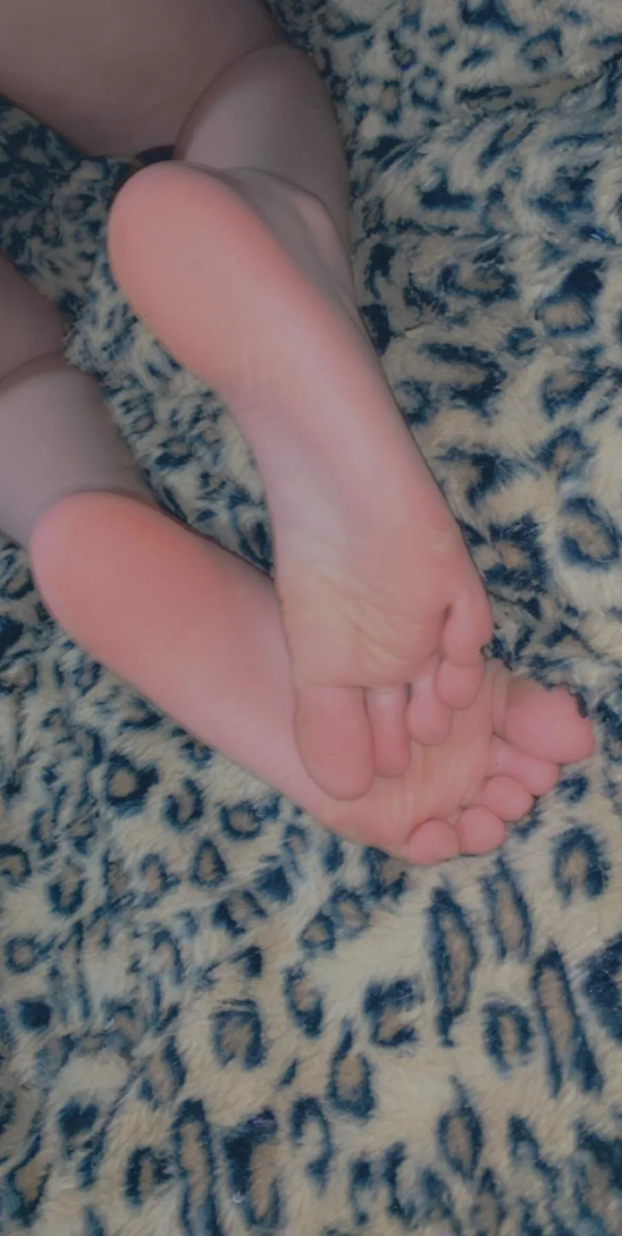 Would you kiss these? posted by crummytortilla