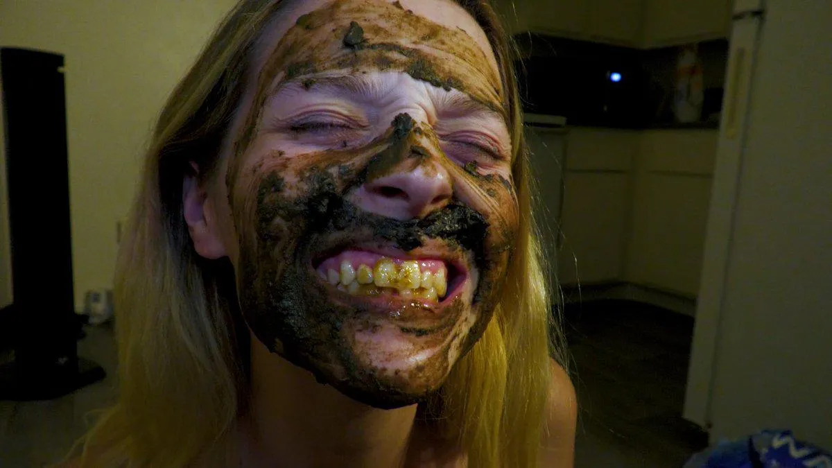 What would my dentist say, if he saw this ?  (f) posted by Rough-Dog-1338