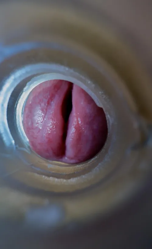 Closeup of my gaped meatotomy. by Own_Theory_4482