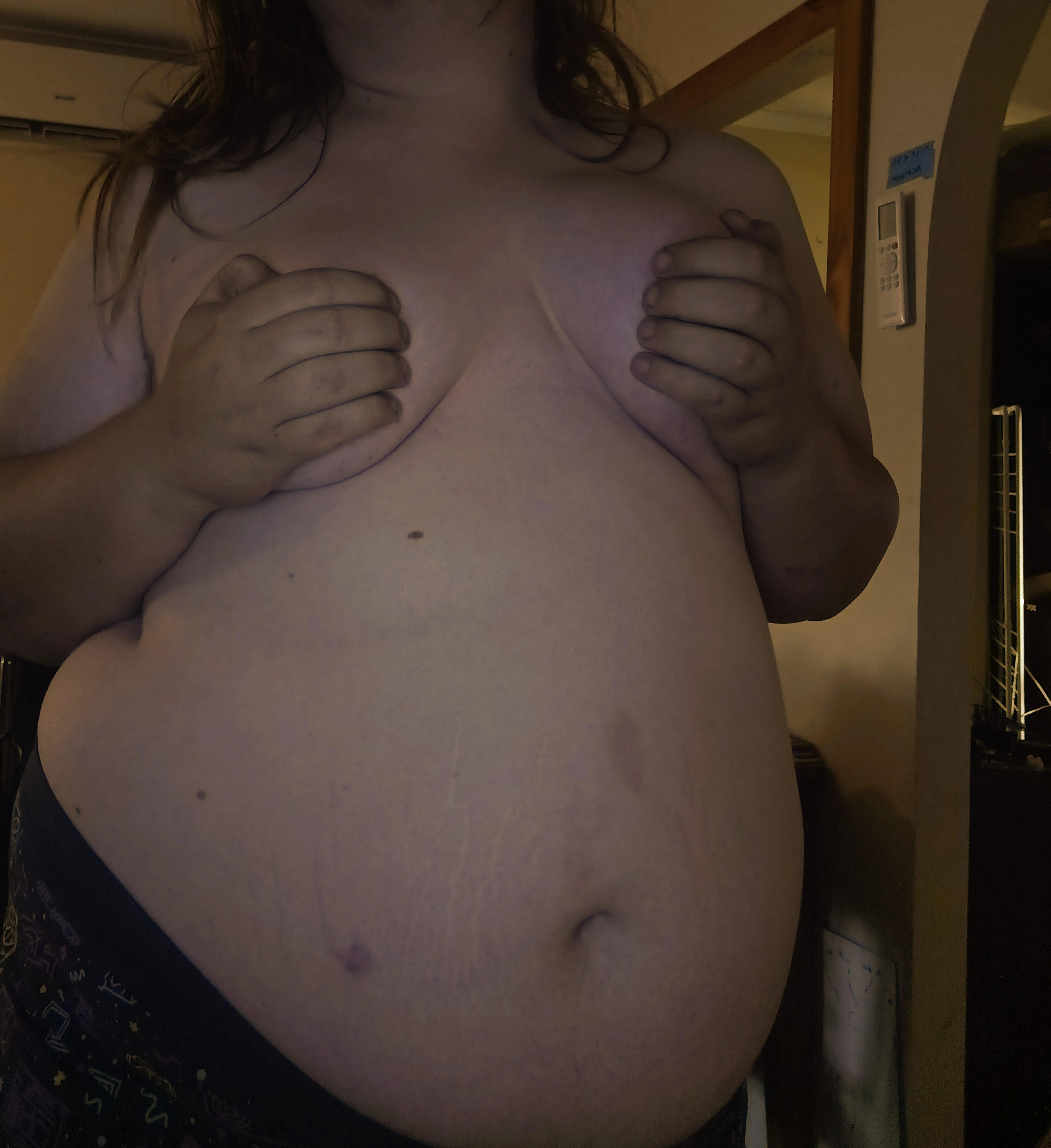 new stretch marks just dropped OMG posted by gainer-nadia