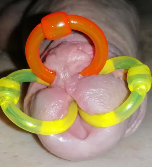 Meatotomy with double PA by Travel_Sucker