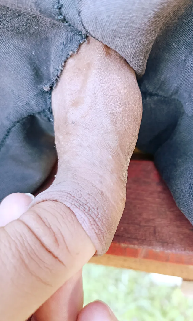  posted by Fancy_Safety_8291