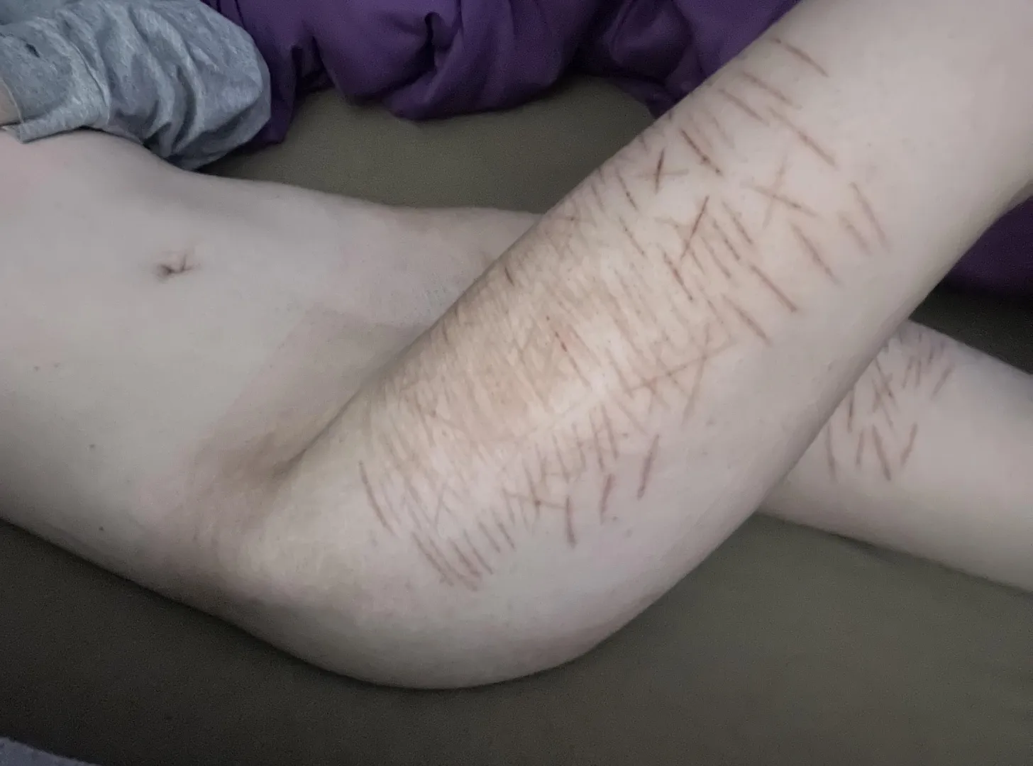  posted by EfficientWitness2591