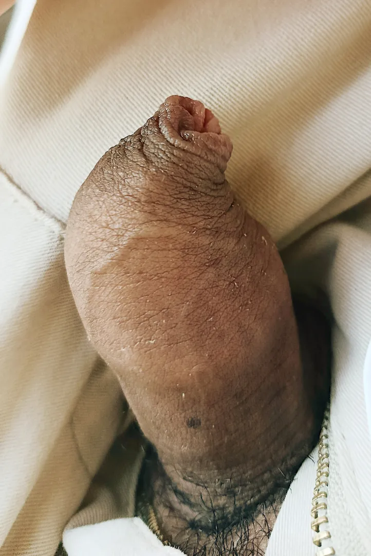  posted by Fancy_Safety_8291