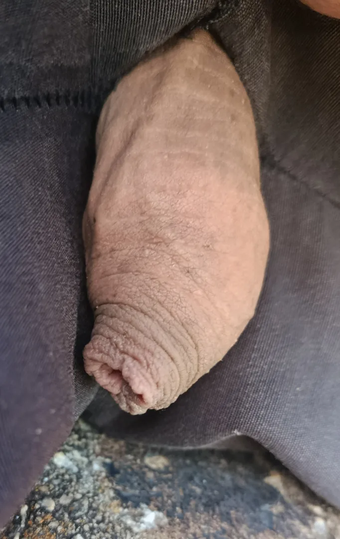  posted by Fancy_Safety_8291