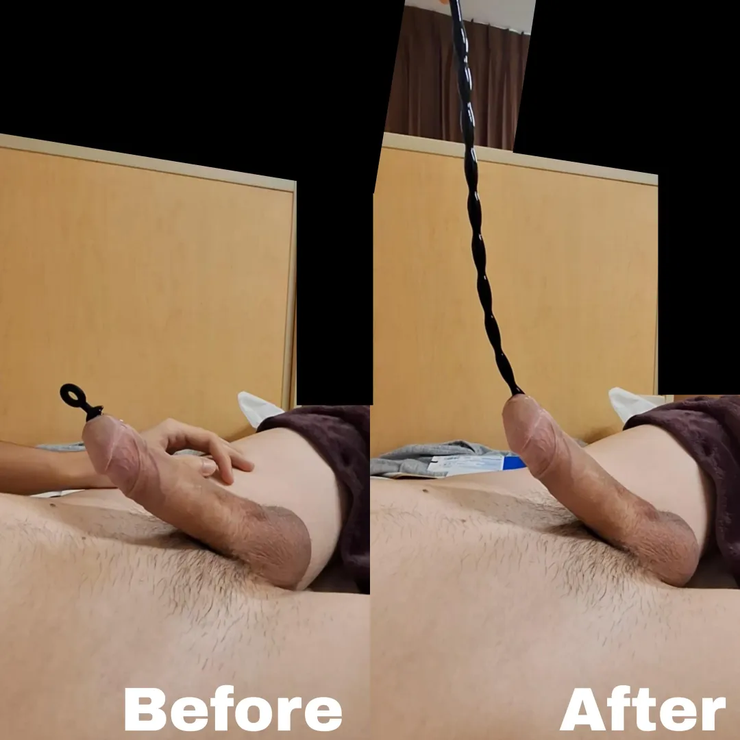 11 inches deep in my urethra posted by Former-Nebula7462