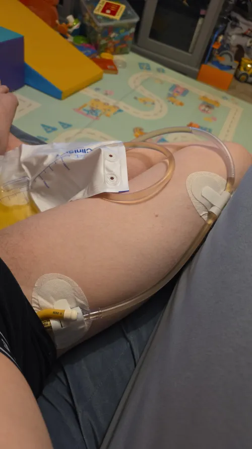 12fr by Emergency_Driver1903