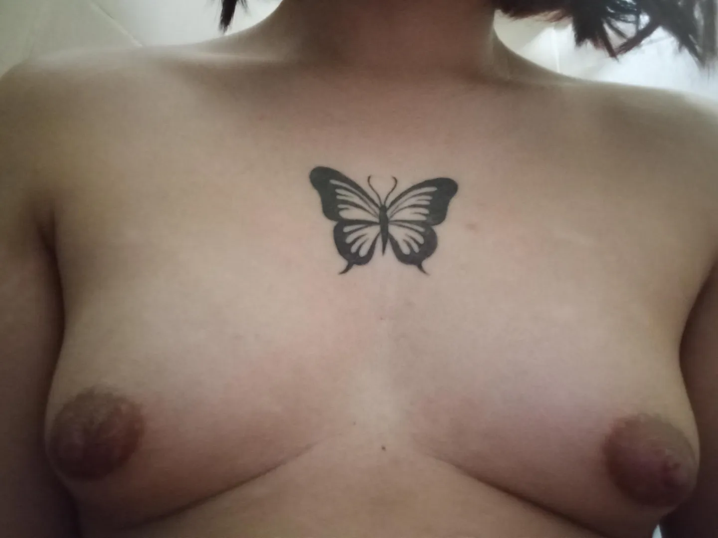 17 months on HRT (Breast update) posted by Mysterious_Squash109
