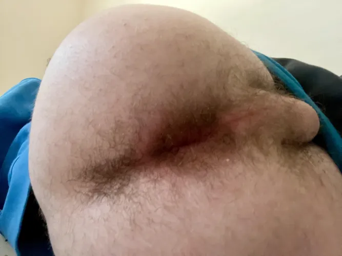 [18] Do you like it? by Ill-External-4474