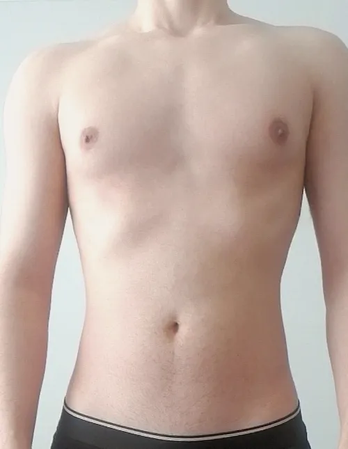 18 how would you try this delicacy? by Legal_Piglet_360