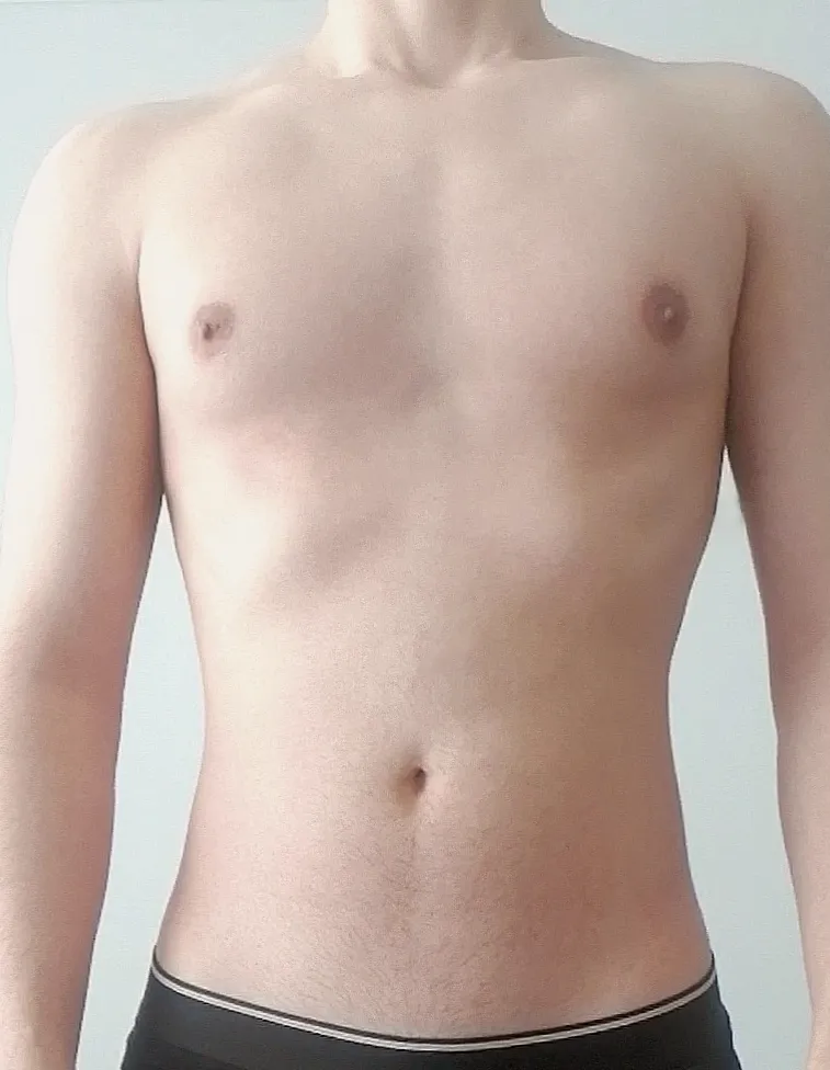 18 how would you try this delicacy? posted by Legal_Piglet_360