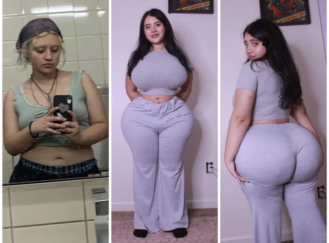 18-19 little over one year difference and 5 surgeries later by imsophicurv