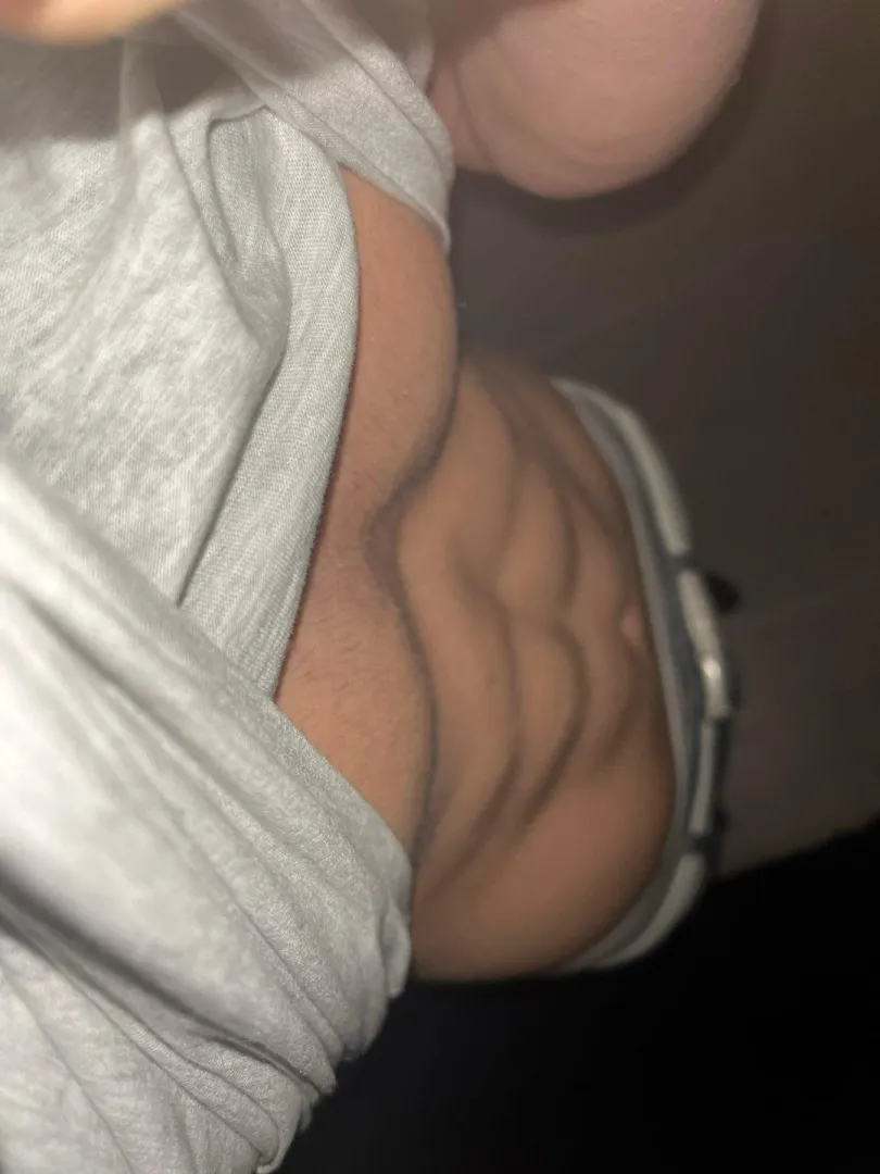 [19] posted by NoYou5656