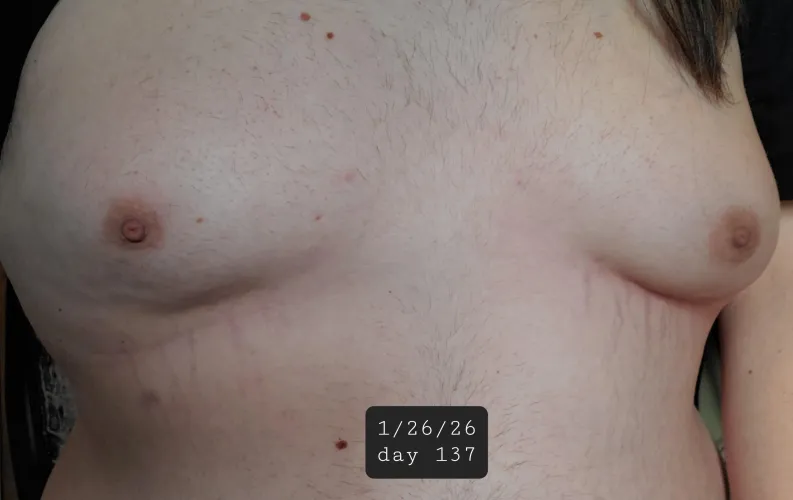 19 weeks by naomisage1