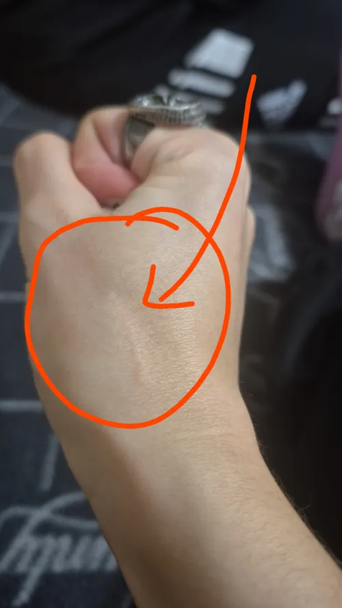 [21F] Scratch or something else? It suddenly appeared on my hand and don't know what caused it. by anobrainidiot