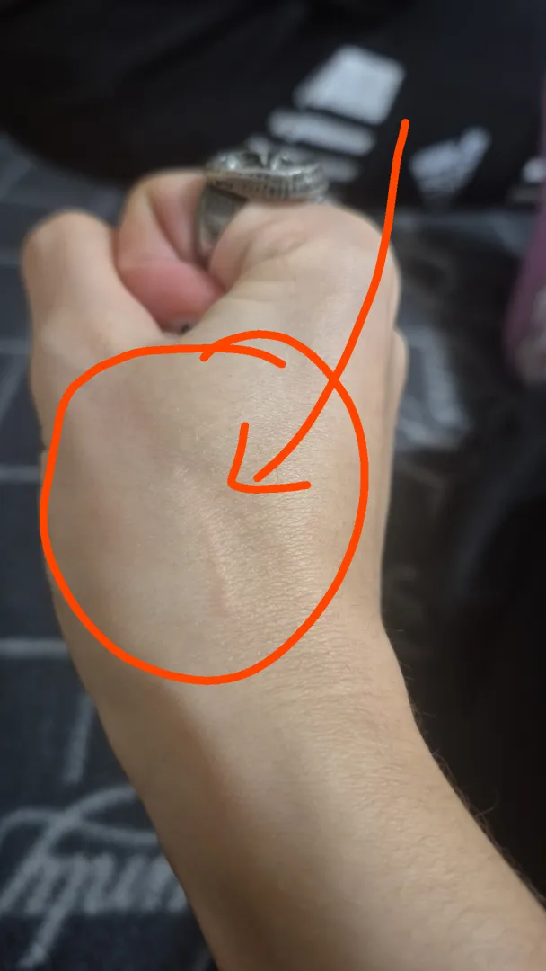 [21F] Scratch or something else? It suddenly appeared on my hand and don't know what caused it. posted by anobrainidiot
